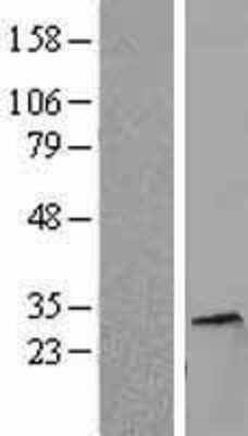 Western Blot: Histone H1.5 Overexpression Lysate [NBL1-11552]