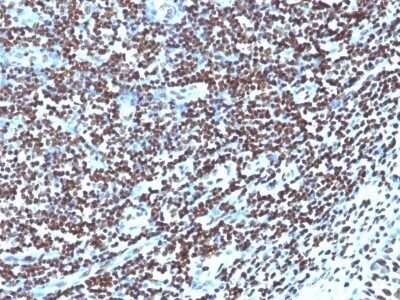 Immunohistochemistry-Paraffin: H1F0 Antibody (1415-1) - Azide and BSA Free [NBP2-47752]