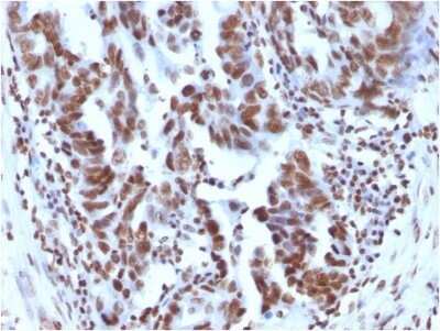 Immunohistochemistry-Paraffin: H1F0 Antibody (1415-1) - Azide and BSA Free [NBP2-47752]