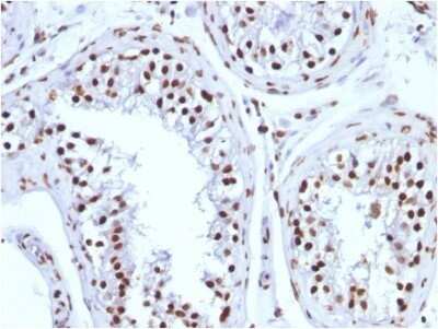 Immunohistochemistry-Paraffin: H1F0 Antibody (1415-1) - IHC-Prediluted [NBP2-48078]