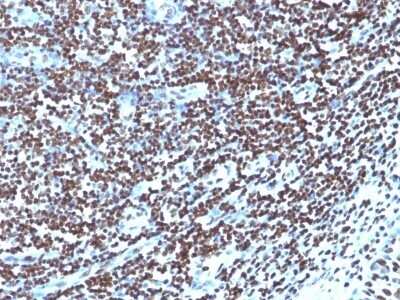 Immunohistochemistry-Paraffin: H1F0 Antibody (1415-1) [NBP2-45181]