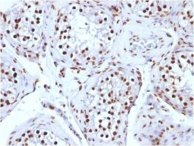 Immunohistochemistry-Paraffin: H1F0 Antibody (AE-4) - Azide and BSA Free [NBP2-47753]