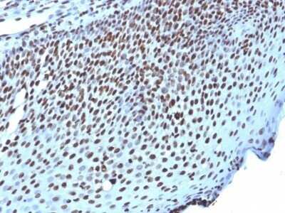 Immunohistochemistry-Paraffin: H1F0 Antibody (AE-4) - Azide and BSA Free [NBP2-47753]