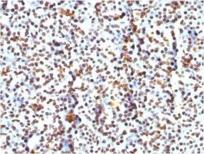 Immunohistochemistry-Paraffin: H1F0 Antibody (AE-4) - IHC-Prediluted [NBP2-48077]