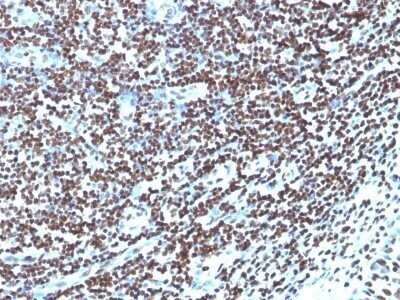 Immunohistochemistry-Paraffin: Histone H1 Antibody (HH1/957) - IHC-Prediluted [NBP2-48087]