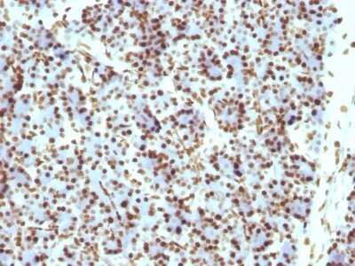 Immunohistochemistry-Paraffin: Histone H1 Antibody (HH1/957) - IHC-Prediluted [NBP2-48087]