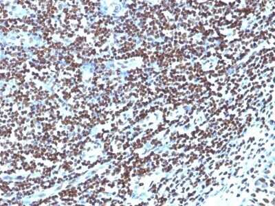 Immunohistochemistry-Paraffin: Histone H1 Antibody (HH1/957) [NBP2-45184]