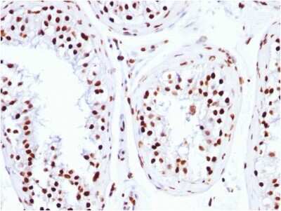Immunohistochemistry-Paraffin: Histone H1 Antibody (HH1/957) [NBP2-45184]