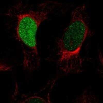 Immunocytochemistry/ Immunofluorescence: Histone H1 Antibody [NBP3-17658]