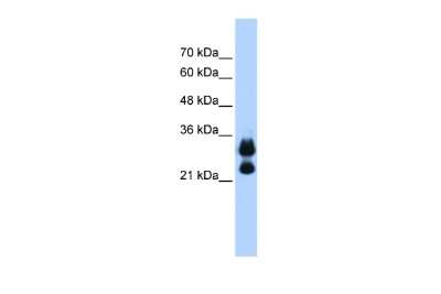 Western Blot: Histone H1.2 Antibody [NBP2-87570]