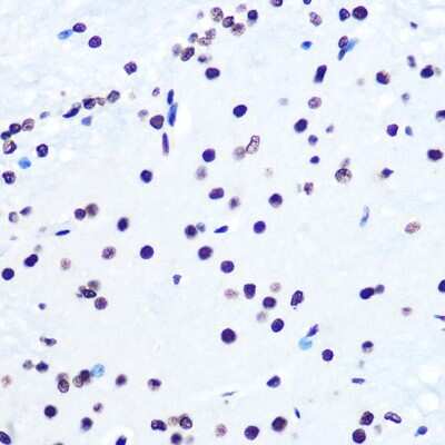 Immunohistochemistry-Paraffin: Histone H2AX Antibody (4Z3S8) [NBP3-15378]