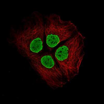 Immunocytochemistry/ Immunofluorescence: Histone H2AY/macroH2A.1 Antibody (CL5245) [NBP2-61155]