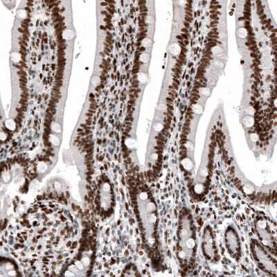 Immunohistochemistry: Histone H2AY/macroH2A.1 Antibody (CL5256) [NBP2-61644]