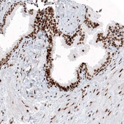 Immunohistochemistry: Histone H2AY/macroH2A.1 Antibody (CL5256) [NBP2-61644]