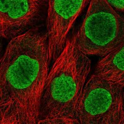 Immunocytochemistry/ Immunofluorescence: Histone H2AY/macroH2A.1 Antibody [NBP2-56819]