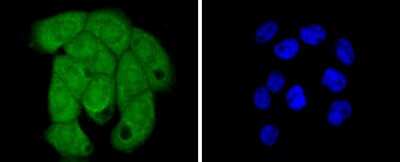 Immunocytochemistry/ Immunofluorescence: Histone H2B Antibody (SD20-63) [NBP2-67753]
