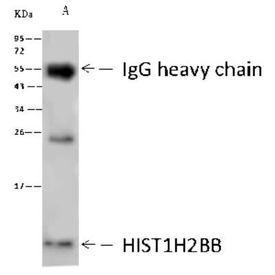 Immunoprecipitation: Histone H2B type 1B Antibody [NBP2-98972]