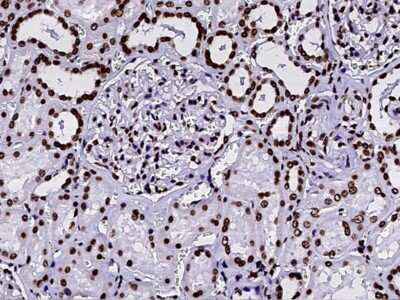 Immunohistochemistry-Paraffin: Histone H2B type 2E Antibody [NBP2-99782]