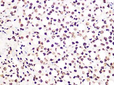 Immunohistochemistry-Paraffin: Histone H3.3 Antibody (5C5B8) [NBP3-16489]