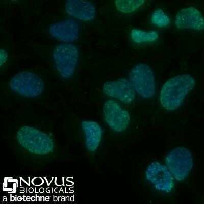 Immunocytochemistry/ Immunofluorescence: Histone H3 [Trimethyl Lys9] Antibody (6F12-H4) - Azide and BSA Free [NBP2-80769]