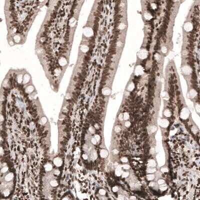 Immunohistochemistry: HIST1H3A Antibody (CL4968) [NBP2-61643]
