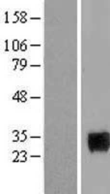 Western Blot: SIX6 Overexpression Lysate [NBL1-15985]