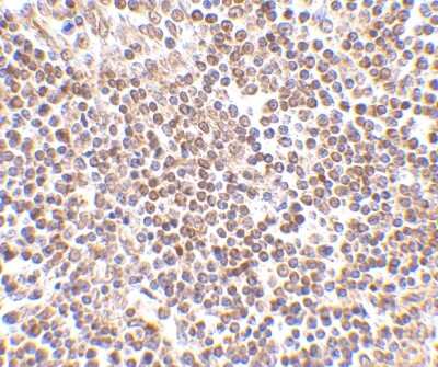 Immunohistochemistry-Paraffin: Hormone-sensitive Lipase/HSL Antibody - BSA Free [NBP1-76735]