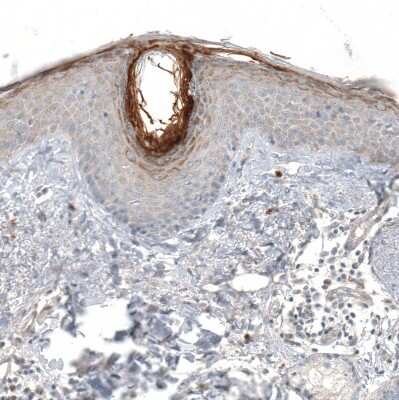 Immunohistochemistry-Paraffin: Hornerin Antibody [NBP1-80807]
