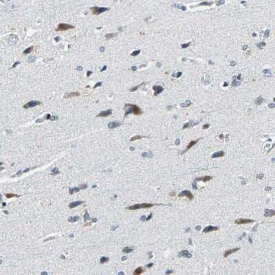 Immunohistochemistry-Paraffin: Host cell factor C2 Antibody [NBP1-92004]