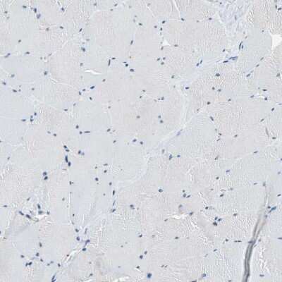 Immunohistochemistry-Paraffin: Host cell factor C2 Antibody [NBP1-92004]