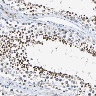 Immunohistochemistry-Paraffin: Host cell factor C2 Antibody [NBP1-92004]