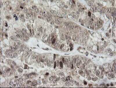 Immunohistochemistry: Host cell factor C2 Antibody (OTI5H9) [NBP2-45733]