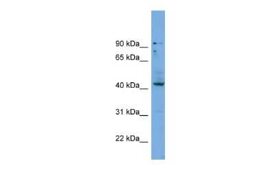 Western Blot: Hoxb3 Antibody [NBP3-09362]