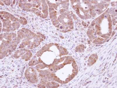 Immunohistochemistry-Paraffin: HSPA8/HSC71/Hsc70 Antibody [NBP2-16882]