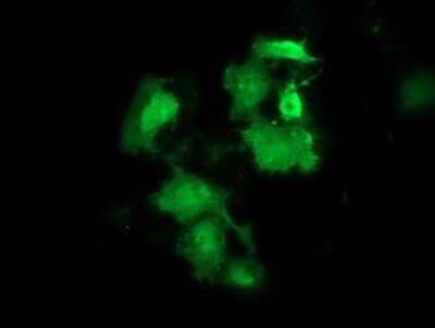 Immunocytochemistry/ Immunofluorescence: HSPB8/HSP22 Antibody (OTI1E3) [NBP2-02576]