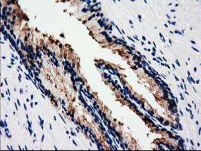 Immunohistochemistry-Paraffin: HSP40/DNAJB1 Antibody (OTI1F9) [NBP2-03433]