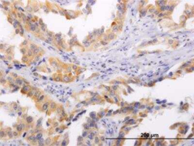 Immunohistochemistry-Paraffin: Hsp47 Antibody (1D2-1A6) [H00000871-M01]
