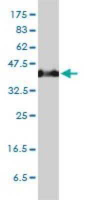 Western Blot: Hsp47 Antibody (1D2-1A6) [H00000871-M01]
