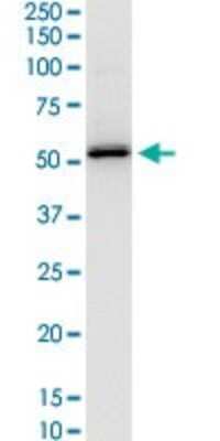 Western Blot: Hsp47 Antibody (1D2-1A6) [H00000871-M01]
