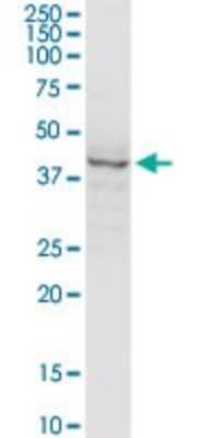 Western Blot: Hsp47 Antibody (1D2-1A6) [H00000871-M01]