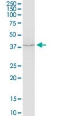 Western Blot: Hsp47 Antibody (1D2-1A6) [H00000871-M01]