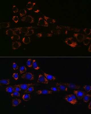 Immunocytochemistry/ Immunofluorescence: Hsp47 Antibody (3K3H1) [NBP3-15430]