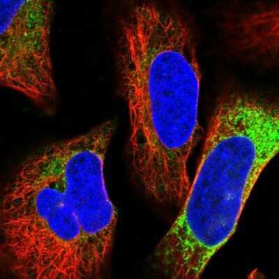 Immunocytochemistry/ Immunofluorescence: Hsp47 Antibody [NBP1-88172]
