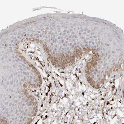 Immunohistochemistry-Paraffin: Hsp47 Antibody [NBP1-88172]