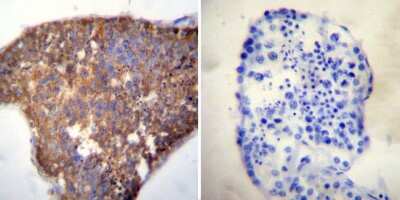 Immunohistochemistry-Paraffin: HSPA8/HSC71/Hsc70 Antibody (13D3) [NB120-2788]