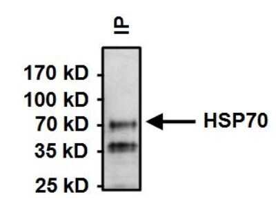Immunoprecipitation: HSPA8/HSC71/Hsc70 Antibody (13D3) [NB120-2788]
