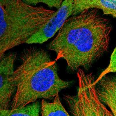 Immunocytochemistry/ Immunofluorescence: Hsp70 interacting protein HIP Antibody [NBP2-48865]