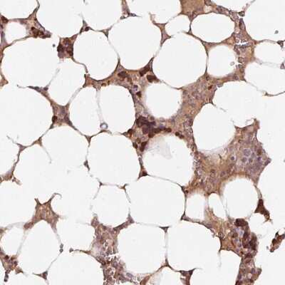 Immunohistochemistry: Hsp70 interacting protein HIP Antibody [NBP2-47427]