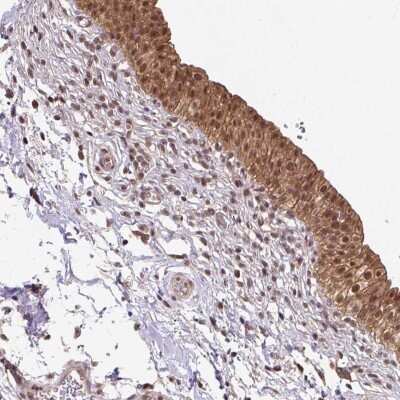 Immunohistochemistry: Hsp70 interacting protein HIP Antibody [NBP2-48866]