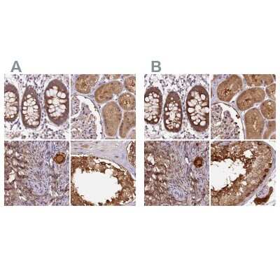 Immunohistochemistry-Paraffin: Hsp70 interacting protein HIP Antibody [NBP2-47427]